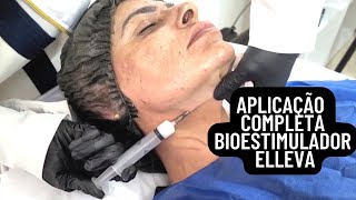 Como é Feita Aplicação Bioestimulador de Colágeno Elleva, completo! Rosto e Pescoço