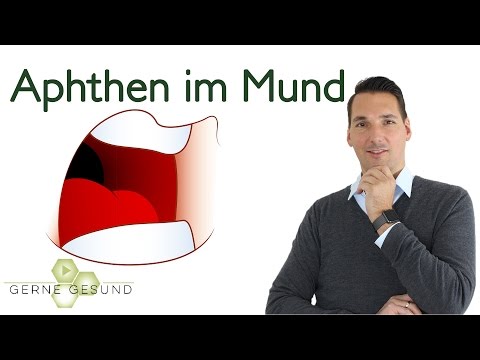 Verstauchung Verletzungen der Kniemuskulatur Wund zurück nach oben