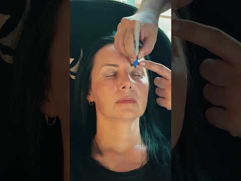 Blepharoplasty Surgery in Antalya 2026