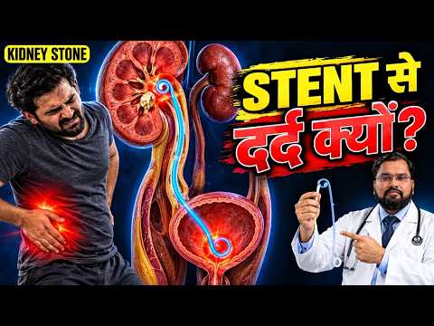 DJ Stent in Hindi | Stent Pain & Removal | DJ Stent क्यों डालते हैं?