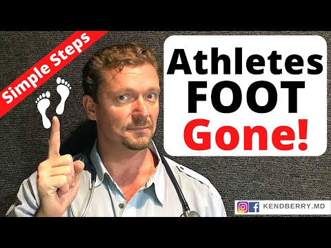 Cure ATHLETES FOOT (Keep it Gone FOREVER) 2024