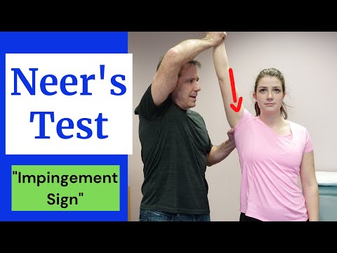 NEER Shoulder Impingement Sign