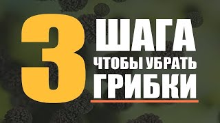 3 Метода Очищения От Грибков | Лечение кандидоза и грибковых инфекций | Кандида. Дрожжи. Плесень