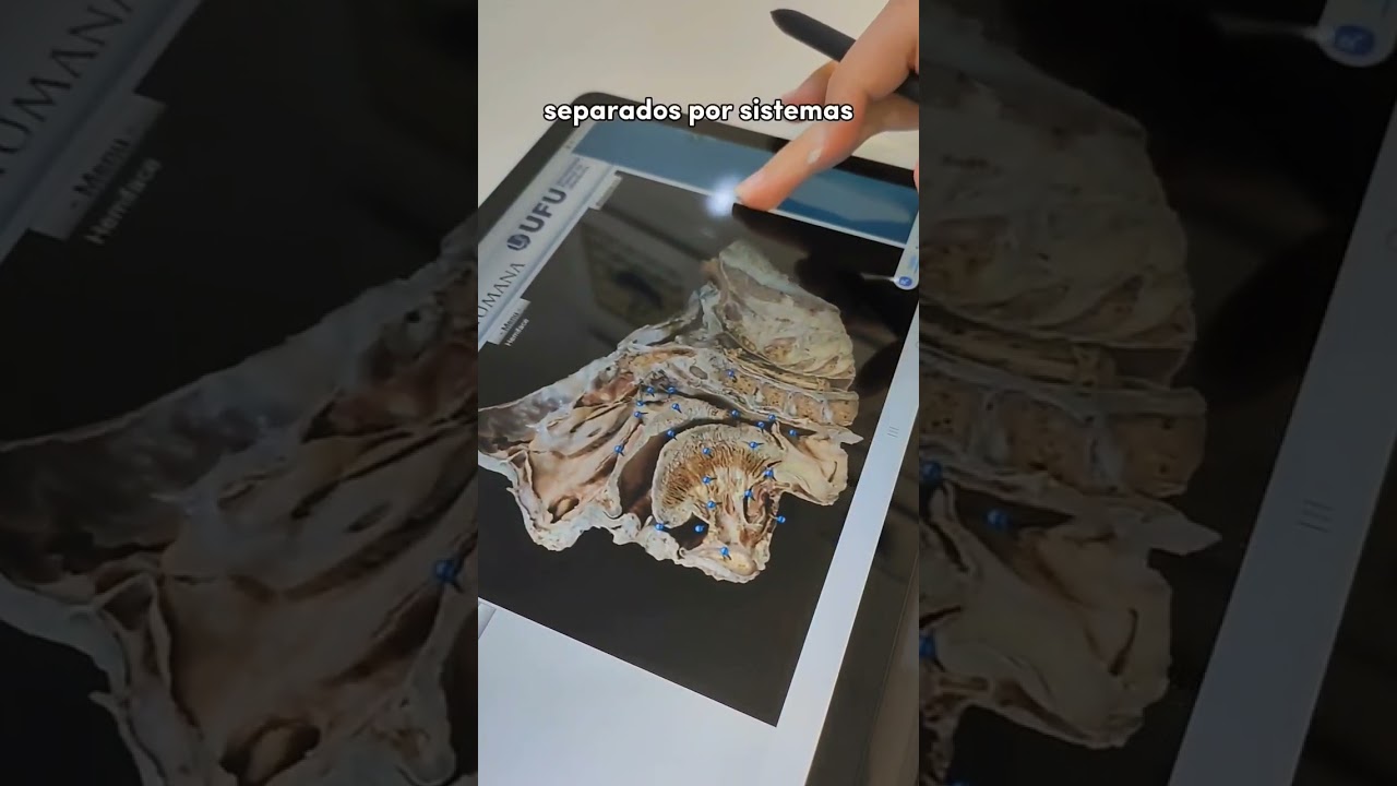 sites e aplicativos para estudar anatomia 💜 #medicina #aesthetic