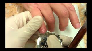 RAPID CUTS SOLAR PINK TECHNIQUE