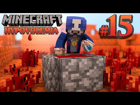 HYPOVOLEMIA FR ep 15 : MINECRAFT MODPACK [FR] Francais