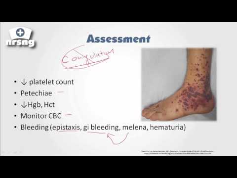 Thrombocytopenia NCLEX® Review | NRSNGacademy.com