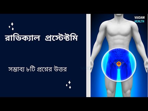 রাডিকাল প্রোস্টেক্টোমি- ৮টি প্রায়শই জিজ্ঞাসিত প্রশ্ন