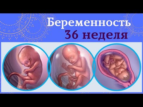 Сколиоз грудного отдела поз Межпозвонковая грыжа шейного отдела позвонка симптомы