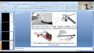 Download Lagu Fetotomy Part-2 by Dr. Dushyant Yadav, Dept. of LFC (VGO), BVC, Patna Thumbnail