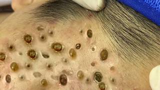 𝐑𝐞𝐟𝐫𝐞𝐬𝐡 𝐘𝐨𝐮𝐫 𝐅𝐚𝐜𝐞 𝐖𝐢𝐭𝐡 LNG 𝐒𝐤𝐢𝐧 𝐂𝐚𝐫𝐞 #