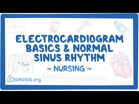 Electrocardiogram (ECG) - Normal sinus rhythm (NSR): Clinical Nursing Care