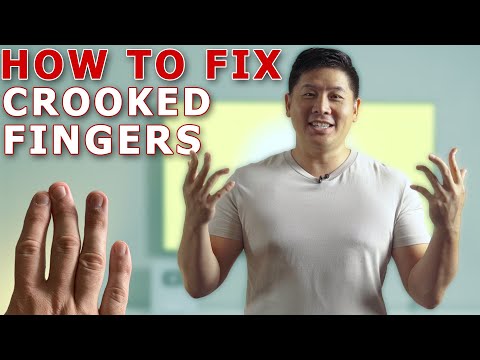 Straighten Your Crooked Fingers With This Simple Trick! | Finger Mobilization By Physical Therapist