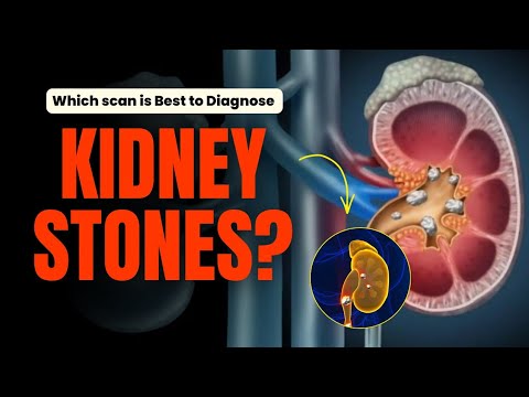 Kidney Stones - Ultrasound vs CT Scan: Which Test Is Best?