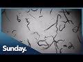 Could A Dose Of Worms Be The Answer To Treating Incurable Autoimmune Diseases