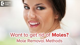 Mole Removal Surgery:Treatment, Healing |Which moles can be removed?-Dr.Rasya Dixit| Doctors