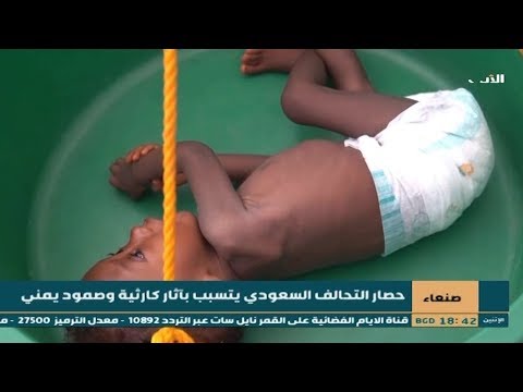 شاهد بالفيديو.. صنعاء |  حصار التحالف السعودي يتسبب بآثار كارثية وصمود يمني