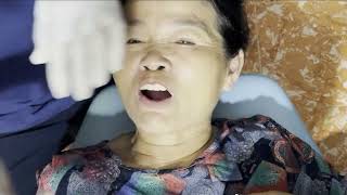 bảo vệ răng dược ổn định cho bệnh nhân