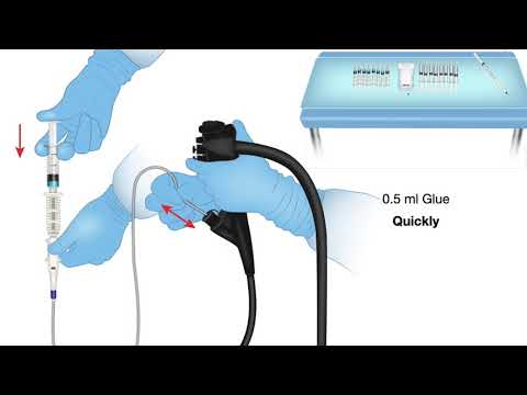 HCC 1472 15b4-Lesson Injection of Glue