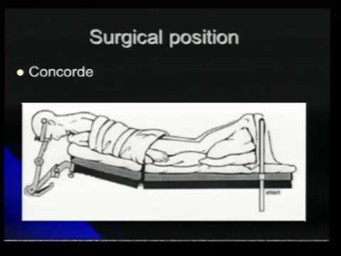 Positioning Craniotomy & Flaps in Neurosurgery