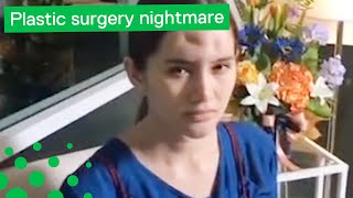 Plastic Surgery Nightmare Leads to Pus Squeezing Operation