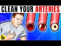 Most Wanted These Foods Clean Your Arteries Can Prevent A Heart Attack, Video Heart Health Foods most popullar! Most Wanted These Foods Clean Your Arteries Can Prevent A Heart Attack, Video Heart Health Foods most popullar!