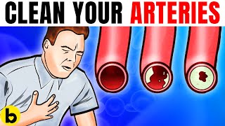 These Foods Unclog Arteries & Can Prevent A Heart Attack
