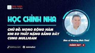 Học chỉnh nha - Nong rộng hàm khi eo thắt nặng bằng dây cung Mulligan #niengrang #dainha #nhakhoa