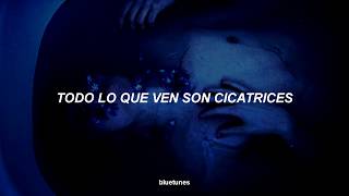 Sixx:A.M. - Skin (sub. español)