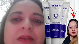 Melannun Age Funciona? MELANNUN AGE  Creme Para Melasma! Melannum Age Onde Comprar? Meu Depoimento!