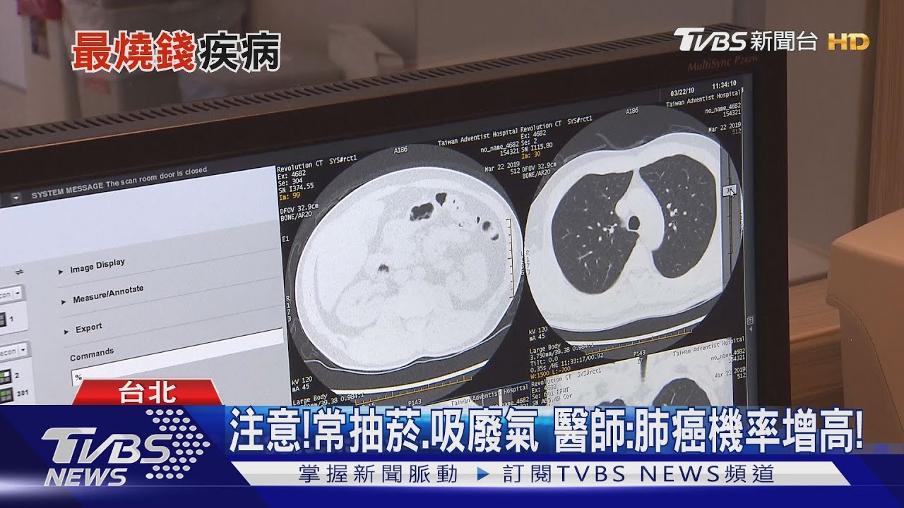 一年耗費533億元 「最燒錢」就是這「病」...折磨人!