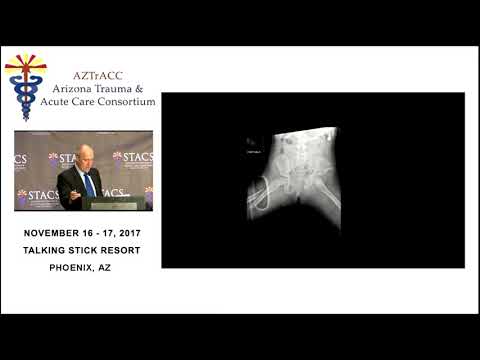 Interactive Case Presentation: Pediatric Trauma 2018