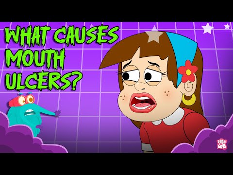 What Causes Mouth Ulcers? | Painful Mouth Sores Explained | Oral Health Facts | Dr. Binocs Show