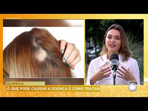 Alopecia: What can cause the disease and how to treat it.