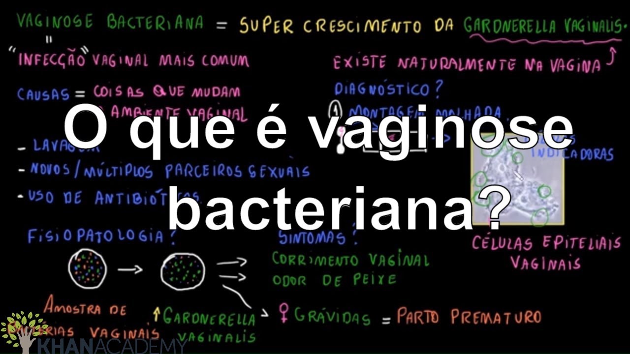 O que é vaginose bacteriana? | Vida e evolução | Khan Academy
