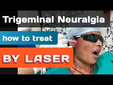Trigeminal Neuralgia Treated With Laser