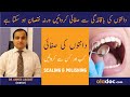 Scaling And Polishing Dental Cleaning Danto Ki Scaling Aur Safai Plaque Removal From Teeth