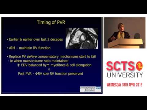 Right ventricular assessment - congenital lessons
