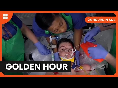 Emergency Trauma Golden Hour at Kings College A&E | 24 Hours in A&E | Medical Documentary