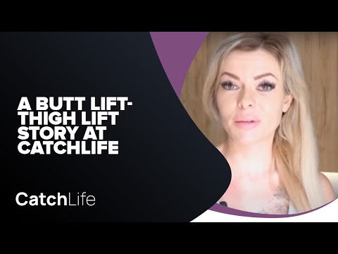 Butt Lift & Thigh Lift in Antalya, Turkey - patients' stories