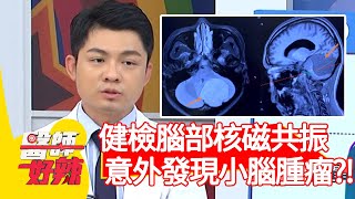 健檢腦部核磁共振，意外發現小腦腫瘤？！【#醫師好辣】20210503 part4 EP1142 宋明樺 洪素卿