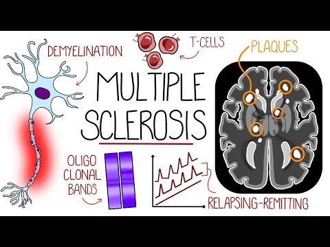 Understanding Multiple Sclerosis (Multiple Sclerosis Explained)