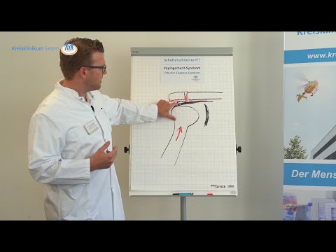 Schulterschmerzen?! Das Impingement-Syndrom als häufigste Ursache