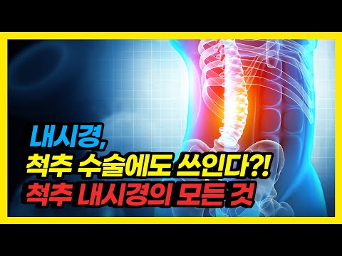 디스크, 척추협착 진단에도 수술 안한다고? 척추내시경수술이 필요한 경우!