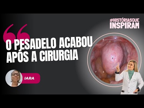 Thumbnail do vídeo