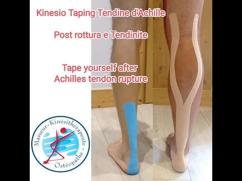 Kinesio Taping Tendine d'Achille. Post rottura e Tendinite. Tape yourself Achilles Tendon rupture
