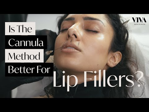 The Cannula Method For Lip Fillers? 💋 (2021) Natural Lip Filler