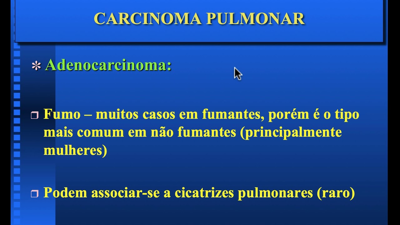CARCINOMA PULMONAR -  PARTE I
