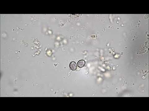 Paraziti giardia lamblia shqip, Giardia paraziti simptome - p5net.ro - Giardia și coccidia la om