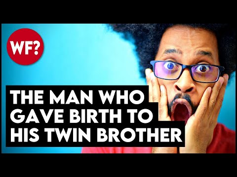 The Man Who Gave Birth -- To His TWIN